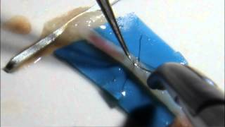 Микрососудистый анастомоз Microvascular anastomosis [upl. by Arukas]