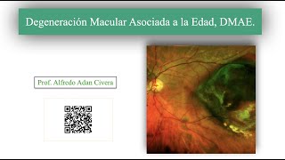 Degeneración Macular Asociada a la Edad DMAE [upl. by Opportuna769]