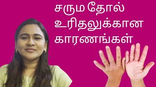 Skin Peeling தோல் உரிதல் DrGayathri Rajesh  Dermatologist  skincare  haircare [upl. by Elfreda]