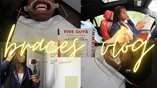 vlog  come with me to get braces for the first time pain level braces appointment food target [upl. by Bork]