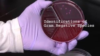 Gram Positive vs Gram Negative Bacteria [upl. by Ennirac795]