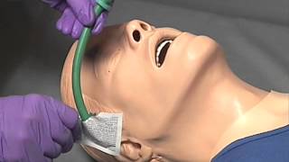 EMS Skills  Nasopharyngeal Airway Insertion [upl. by Nnyletak371]