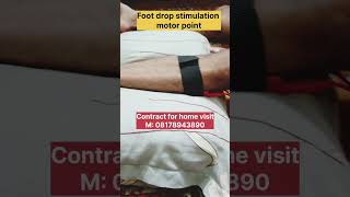 Stroke paralysis foot drop stimulation motor point trending viralvideo shortvideo shorts viral [upl. by Aekin]