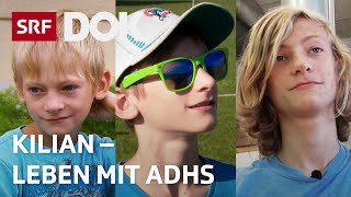 Eine Kindheit mit ADHS  Leben mit dem Aufmerksamkeitsdefizitsyndrom  Reportage  SRF [upl. by Nnylatsirk209]