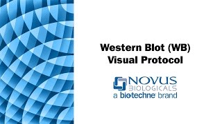 Western Blot WB Visual Protocol [upl. by Nibuz]