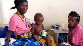 Malnutrition Africa Angola Ethiopia Severe Acute Malnutrition [upl. by Frymire]