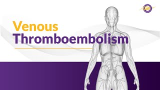 What is Venous Thromboembolism [upl. by Ebbie]