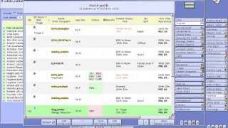 Worklist Management Meditech 6 [upl. by Nadirehs]