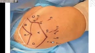 Arthroscopic Anatomy of the Shoulder [upl. by Aserahs]