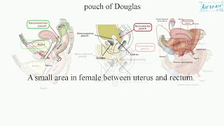 Anatomy and Clinical anatomy of Pouch of Douglas Rectouterine pouch Rectovesical pouch [upl. by Mimajneb]