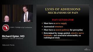 Dr Richard Epter Epidurolysis of Adhesions [upl. by Bidle679]