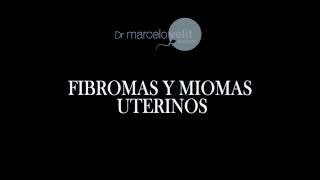 FIBROMAS Y MIOMAS UTERINOS [upl. by Grossman]