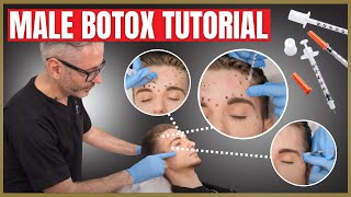 Botox Tutorial For Men  Botox Injection Patterns  Forehead Corrugators amp Crows Feet [upl. by Winnie]