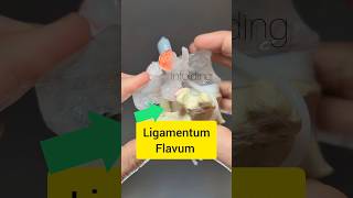 Ligamentum Flavum Modelling  Dynamic Disc Designs [upl. by Keldon]