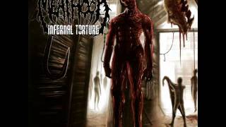 Inflicted Torture  MEATHOOK [upl. by Nived]