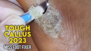 LARGE CALLOUS SHAVING 2023  CALLUS SHAVING FROM SIDE OF THE FEET  SATISFYING BY MISS FOOT FIXER [upl. by Mall]