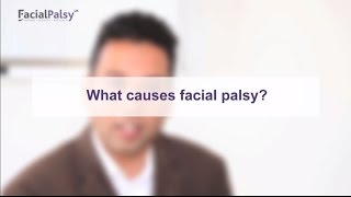 What causes facial palsy in the majority of cases [upl. by Black]