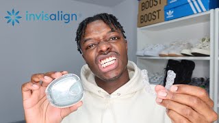 LIFE AFTER INVISALIGN  PERMANENT VS NIGHT TIME RETAINER  MARLON T [upl. by Icnan]