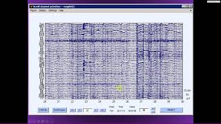 Filter epoch baseline subtraction referencing [upl. by Lugo]