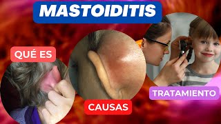 La mastoiditis  que es [upl. by Adnamma]