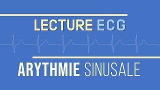 Interprétation ECG  Arythmie Sinusale [upl. by Orgalim]