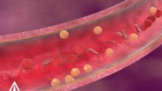 Cholesterol  3D Medical Animation [upl. by Aisatsanna373]