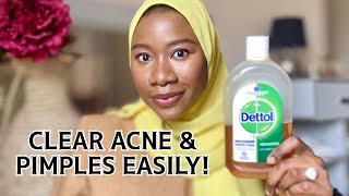 Dettol Antiseptic Liquid  How to use Antiseptic   Uses of Dettol Antiseptic Liquid [upl. by Rann]