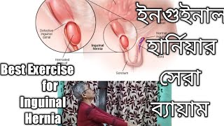 Best Exercise for Inguinal Herniaইনগুইনাল হার্নিয়ার সেরা ব‍্যায়ামnominordebotare [upl. by Flemings]