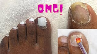 HOW TO Fix Toe Nails With Polygel And Perfectly Gel Polish AT HOME [upl. by Almeria]