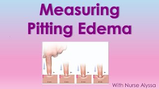 How to measure Pitting Edema [upl. by Ottavia527]