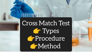 Cross Match Test  Procedure  Types  Method [upl. by Akirderf876]