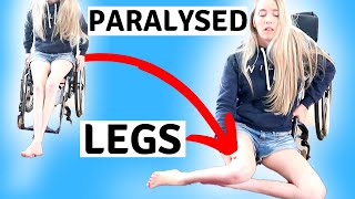 ♿️MY PARALYSED LEGS  limbdifferenceawarenessmonth [upl. by Kenneth]