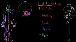 Syndrome Cerebellar syndromes [upl. by Yllus]