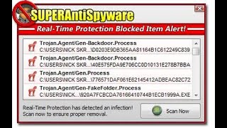 Best Free Antimalware  SUPERAntiSpyware  Free   Pro Edition 14 Days Try  20240101 0559 [upl. by Sucramaj40]