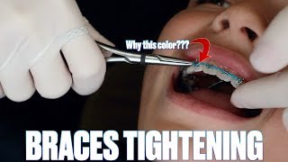 GETTING BRACES TIGHTENED FOR THE FIRST TIME  CHANGING BRACES RUBBER BANDS COLOR  HIDDEN MEANING [upl. by Deloria470]