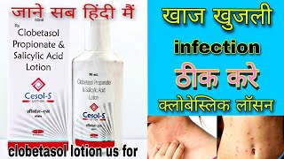 खाज खुजली हो तो क्या करे 🥶🧑‍⚕️CLOBETASOL PROPIONATE amp SALICYLIC ACID LOTION clobetasol lotion [upl. by Nitneuq]