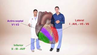 ECG for Beginners ECG Diagnosis of ST Elevation Myocardial Infarction STEMI [upl. by Anikes]