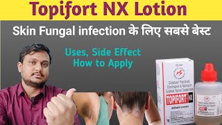 Skin इंफेक्शन की पावरफुल दवा । Topifost NX lotion  Topifort NX how to useGayatrimedical00 [upl. by Lalo]