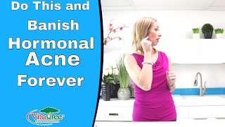 Banish Hormonal Acne Forever by Doing This VitaLife Show Episode 239 [upl. by Hudson]