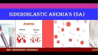 Lecture 17 Sideroblastic Anemia  SA [upl. by Jarvey]