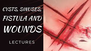 CYSTS SINUSES FISTULA WOUNDS lecture 1 DERMOID and SEBACEOUS CYSTS easy explanation [upl. by Goldina]