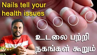 Nails tell your health issues  Lunula  Lets Learn Ep  10  Tamil  Santhosh Babu [upl. by Auqinimod20]