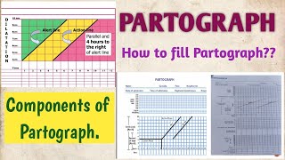 PARTOGRAPH COMPONENTS OF PARTOGRAPH HOW TO FILL OR PLOT PARTOGRAPH [upl. by Brinna]