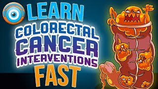 Colorectal Cancer Treatment Step 1 COMLEX NCLEX® PANCE AANP [upl. by Yditsahc]