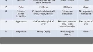 APGAR Score [upl. by Ruperto]