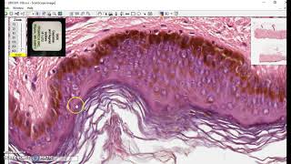 Keratinized stratified squamous epithelium [upl. by Feer]