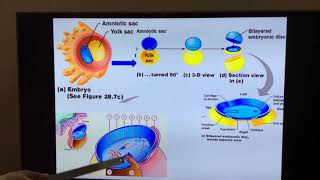 Part I Formation of trilaminar germ disc  Primitive streak [upl. by Annamaria]