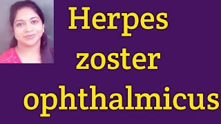 Herpes Zoster Ophthalmicus Hutchisons rulePost herpetic neuralgia Treatment of Herpes Zoster [upl. by Ling276]