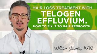 Telogen Effluvium Hair Loss  What is it How To Fix It Fast [upl. by Elyod]