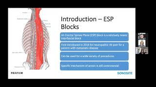 Webinar ESP Blocks for Spinal Surgery [upl. by Barber]